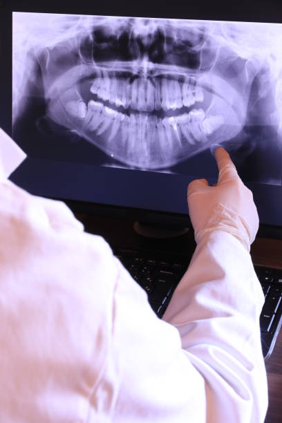 Best Broken or Chipped Tooth Repair in Ellicott City, MD
