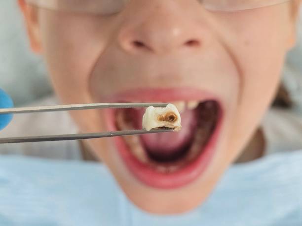Best Walk-In Emergency Dental Services in Ellicott City, MD